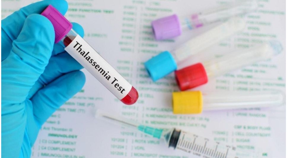 Thắc mắc thường gặp về bệnh Tan máu bẩm sinh - Thalassemia 1
